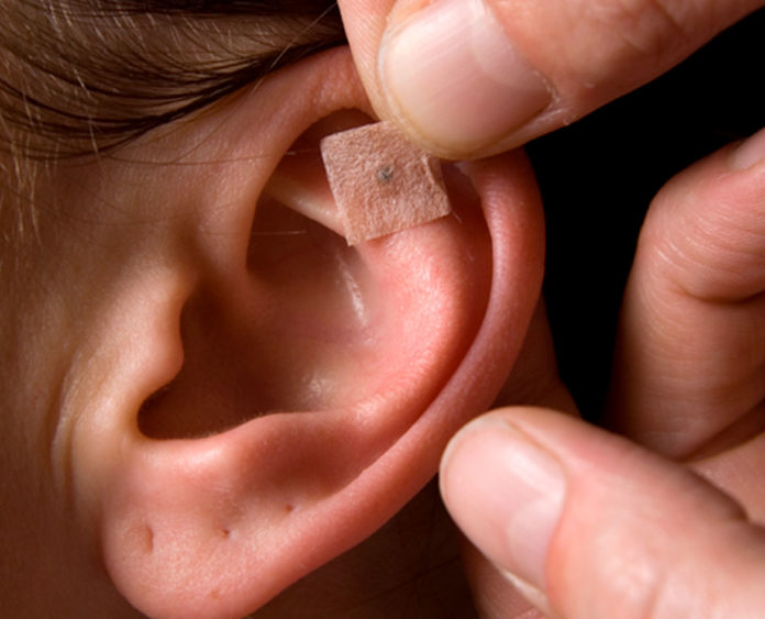 terapias_auriculoterapia